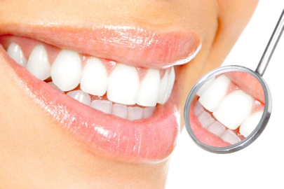 Diş beyazlatmada doğru bilinen yanlışlar!